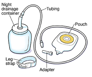Parts of night drainage system.