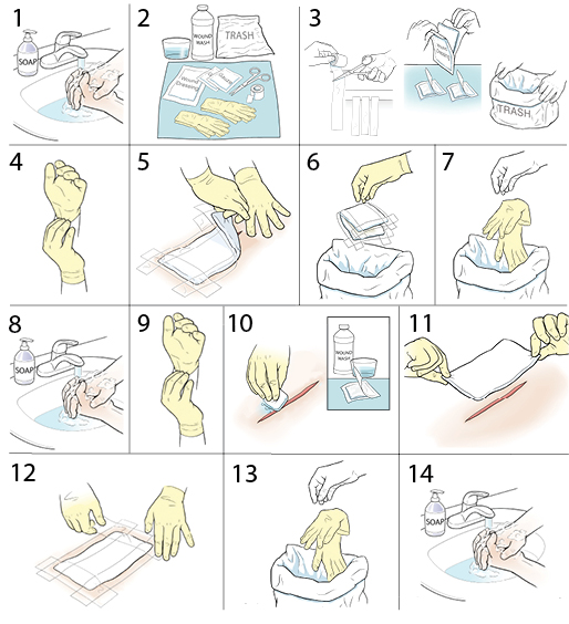 Krames Online StepbyStep Changing a Wound Dressing