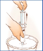 Imagen de una sonda de alimentación