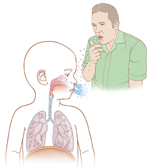 Hombre tosiendo y esparciendo gotitas en el aire. Niño respira las gotitas.